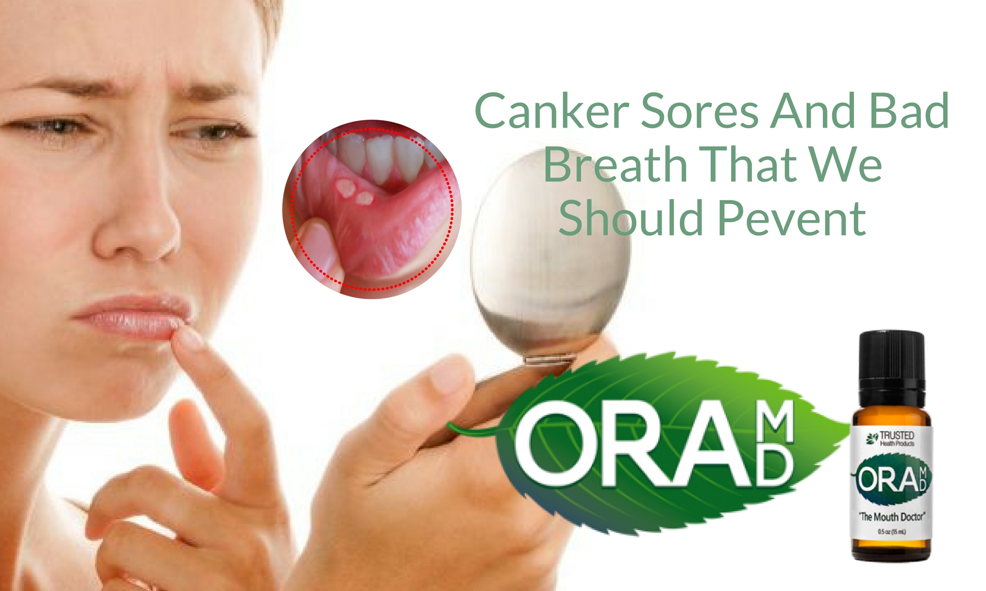 Canker Sores And Bad Breath That We Should Pevent