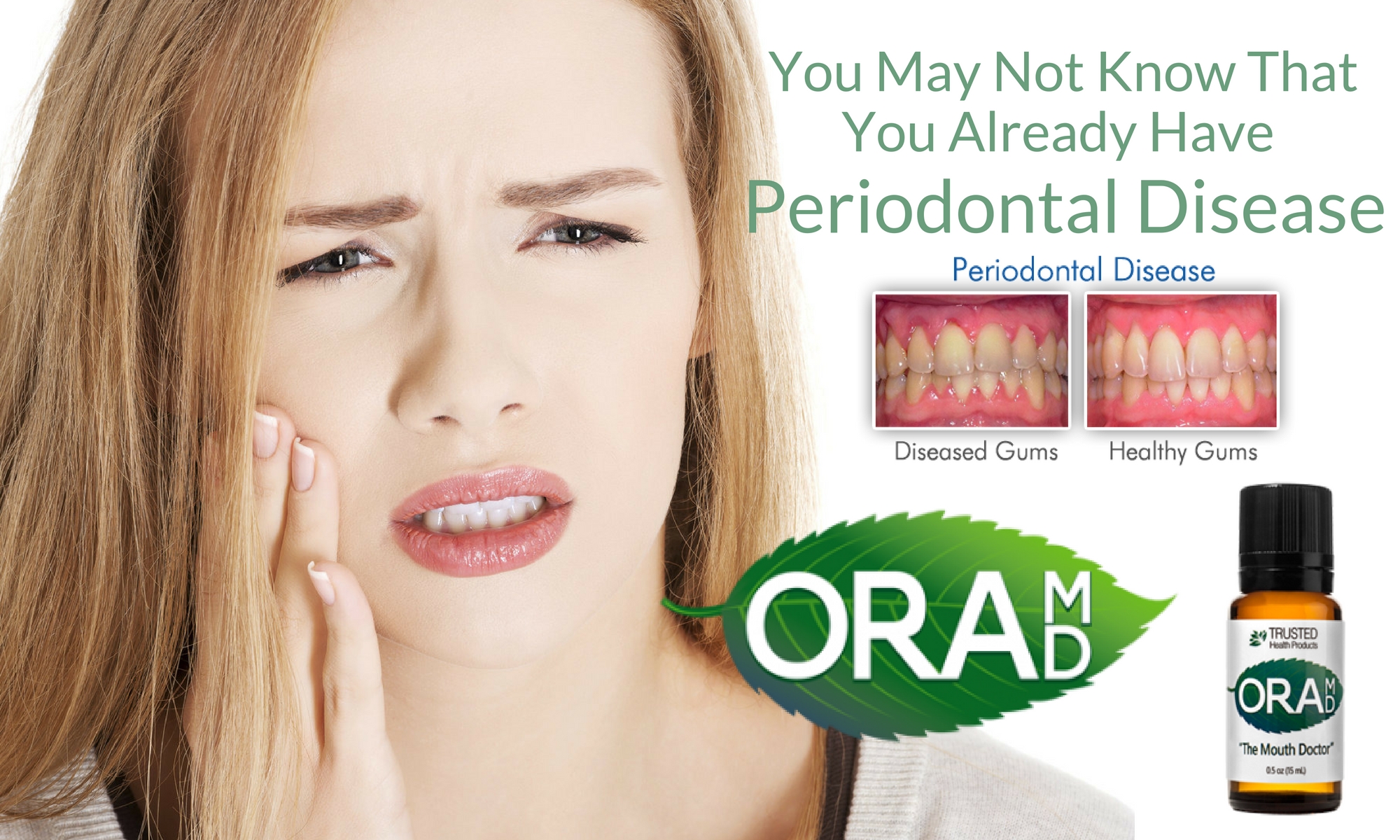 you-may-not-know-that-you-already-have-periodontal-disease